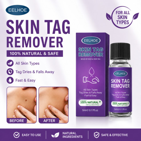 (1 pcs) EELHOE Skin Wart Remover (5ml)