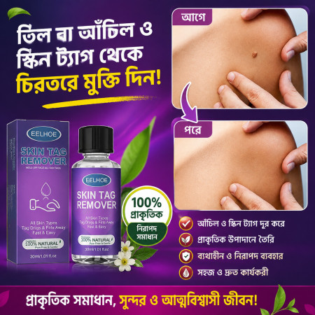 (1 pcs) EELHOE Skin Wart Remover (5ml)