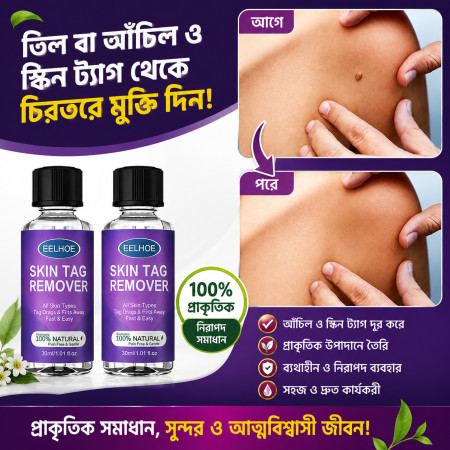 (3 pcs) EELHOE Skin Wart Remover (15 ml)