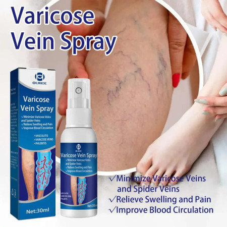 (2pcs) Varicose Veins Spray